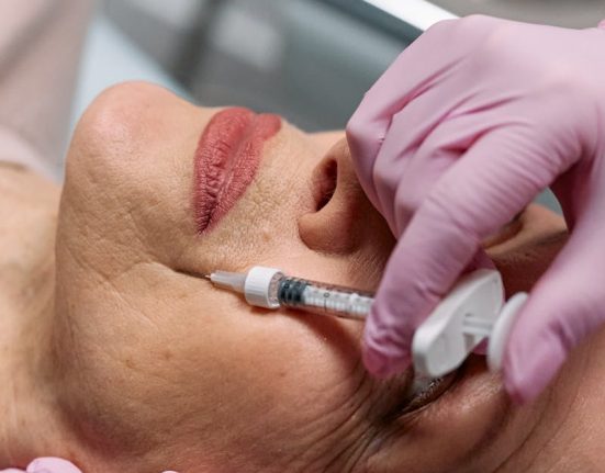 Botox şişliği nasıl geçer