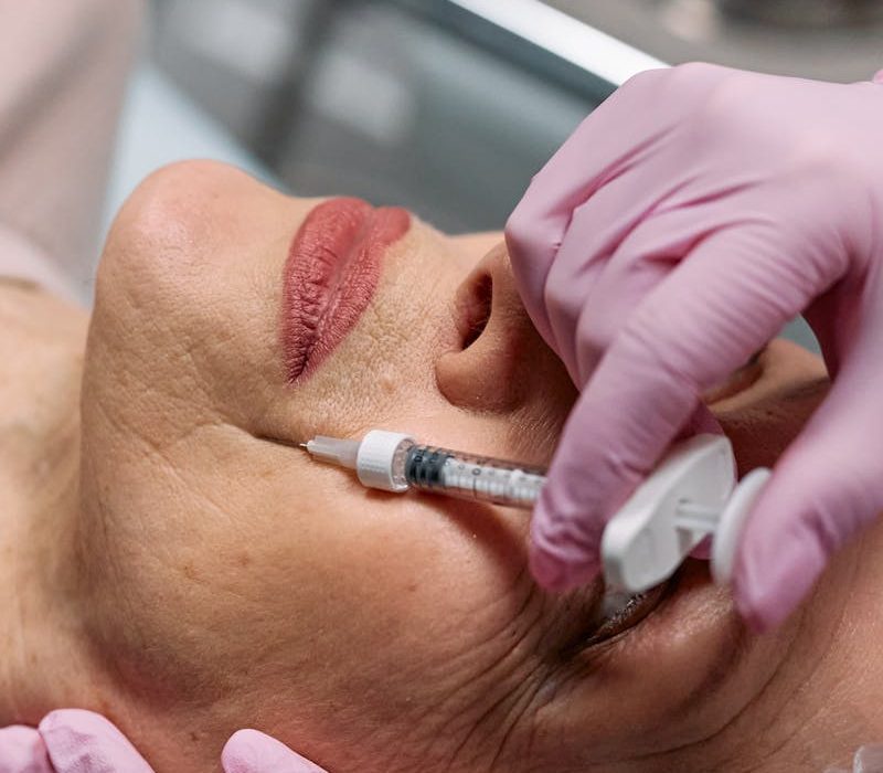 Botox şişliği nasıl geçer